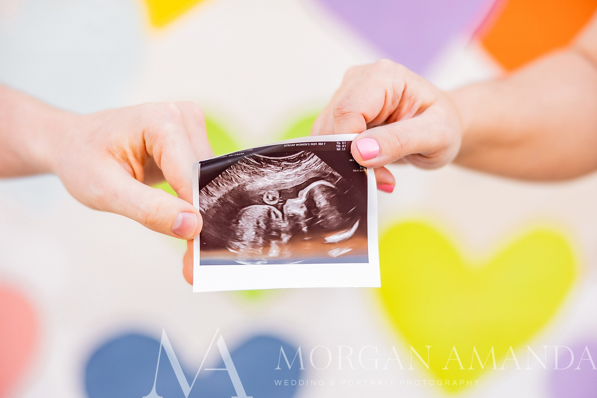 couple holds sonogram photo by heart wall in Uptown Charlotte 